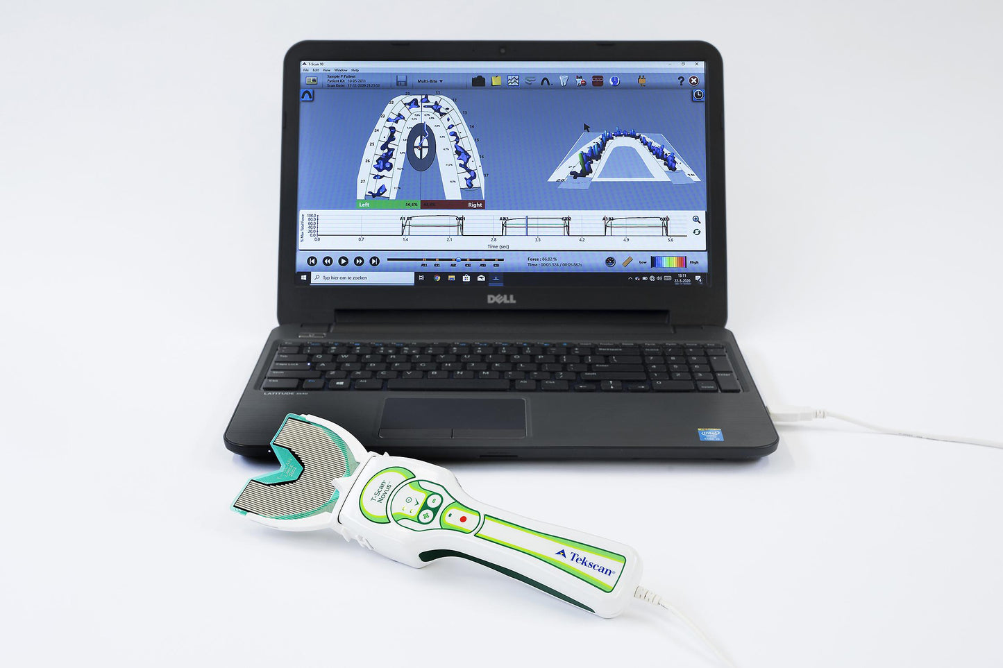 T-Scan Novus® Core® System