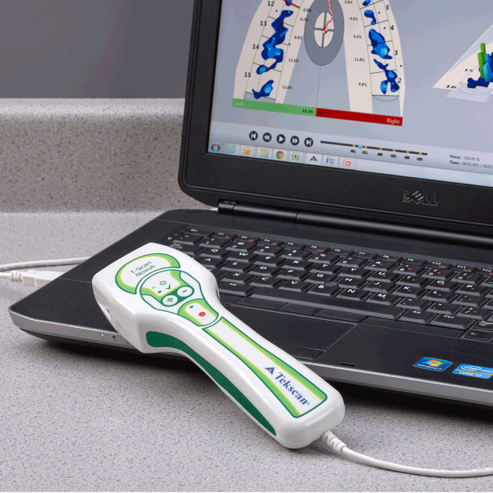 T-Scan Novus System