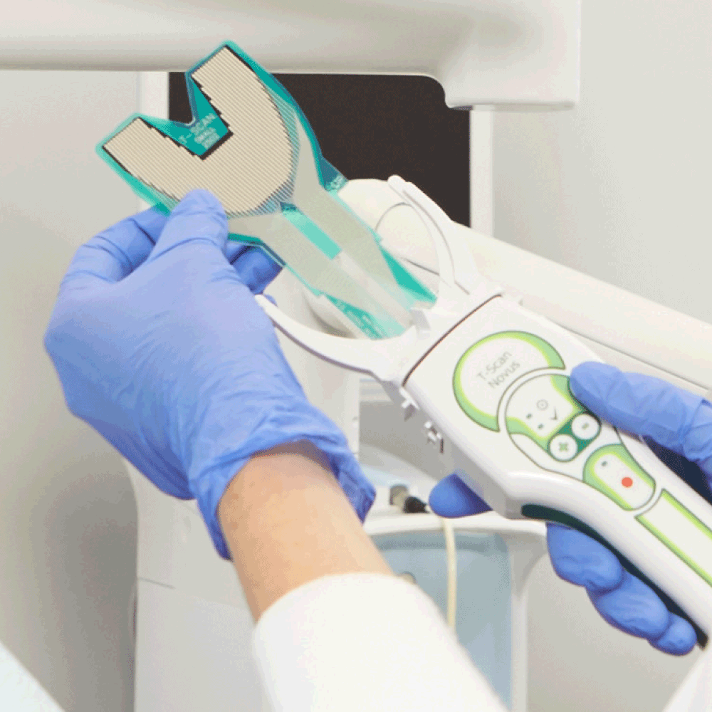 T-Scan Novus System